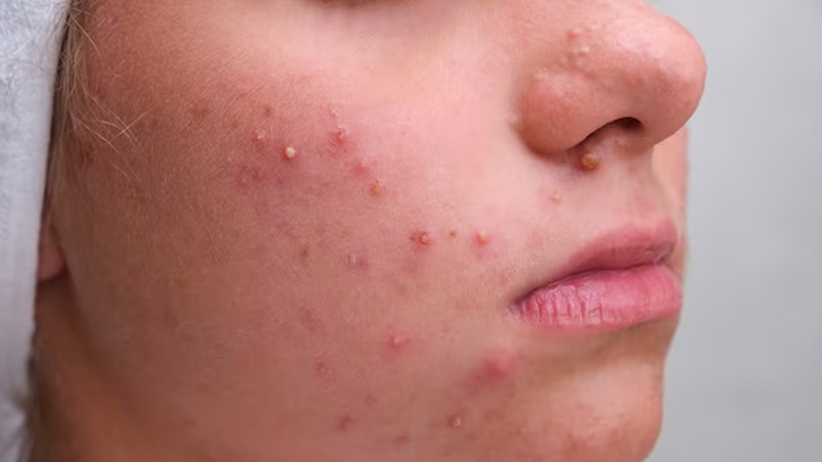 wrong skin care routine