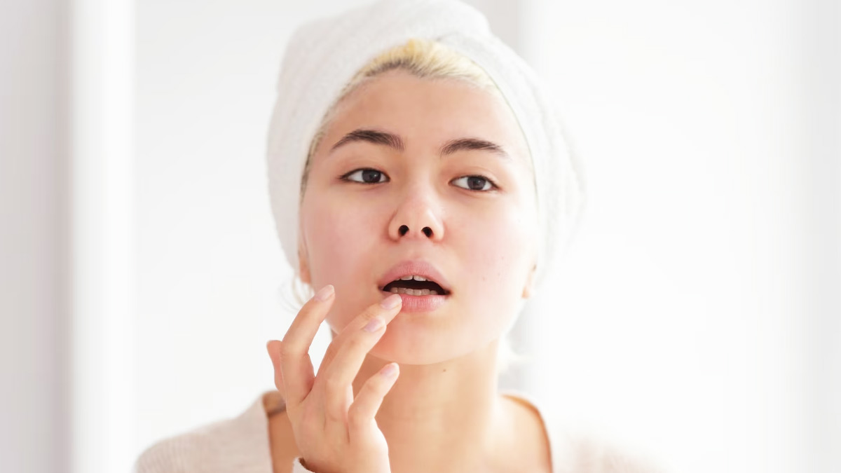 dry lips treatment in hindi