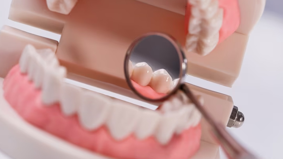 What Are Dental Crowns & Bridges, Expert Weighs In