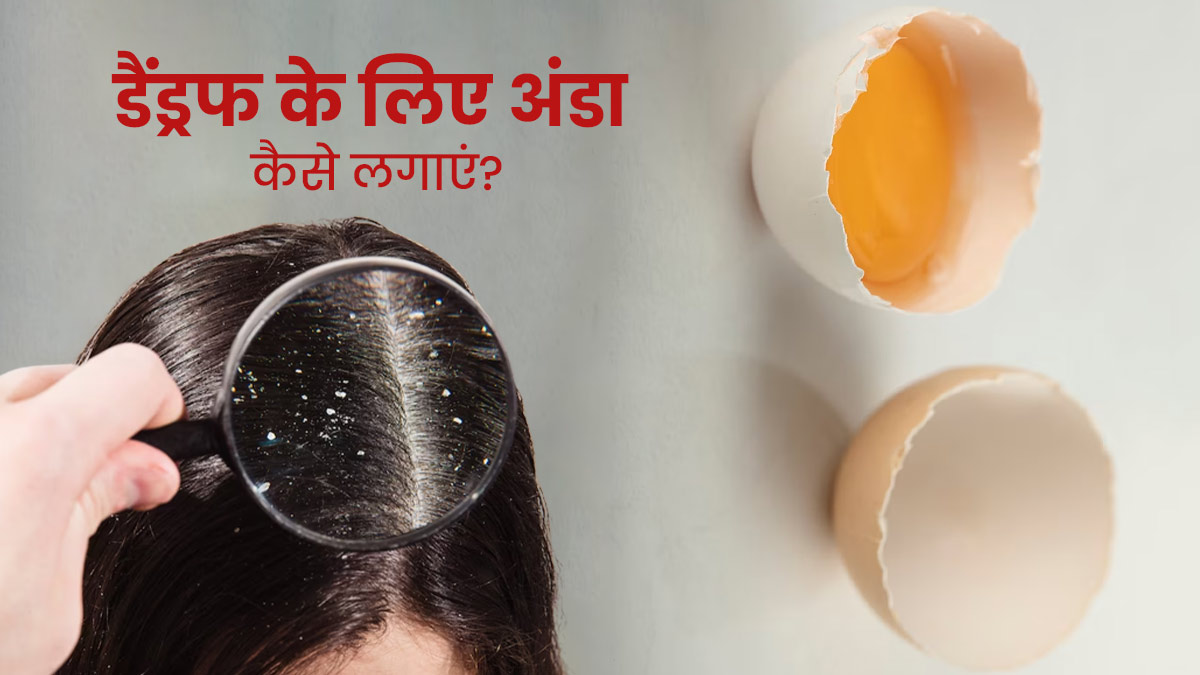 डैंड्रफ से छुटकारा पाने के लिए बालों में इस तरह लगाएं अंडे की सफेदी, मिलेंगे कई फायदे