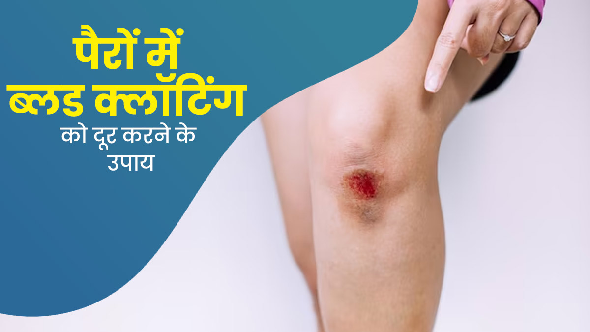 पैरों में खून जमने पर आजमाएं ये 5 घरेलू उपाय, जल्द मिलेगा छुटकारा