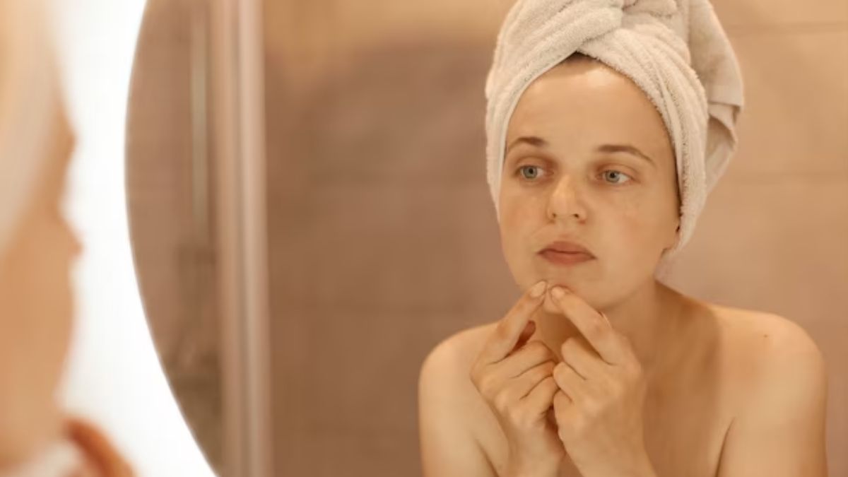 Remove Blackheads With Baking Soda