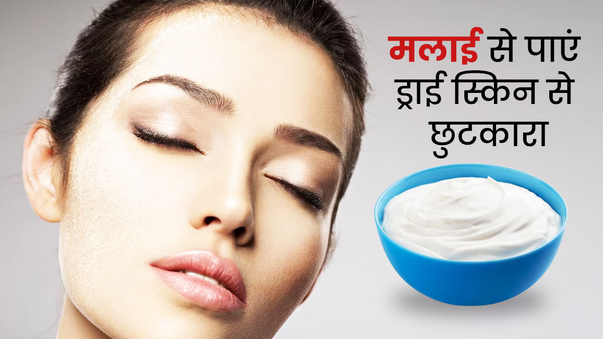 ड्राई स्किन से छुटकारा पाने के लिए लगाएं मलाई, जानें प्रयोग का तरीका