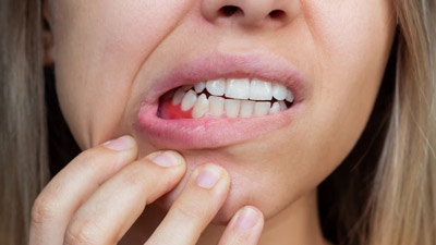 Not Just Sweets, These Savoury Foods Can Also Damage Your Teeth