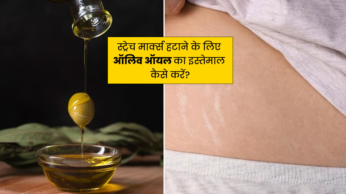 स्ट्रेच मार्क्स हटाने के लिए इन 5 तरीकों से करें ऑलिव ऑयल का इस्तेमाल, जल्दी दिखेगा असर