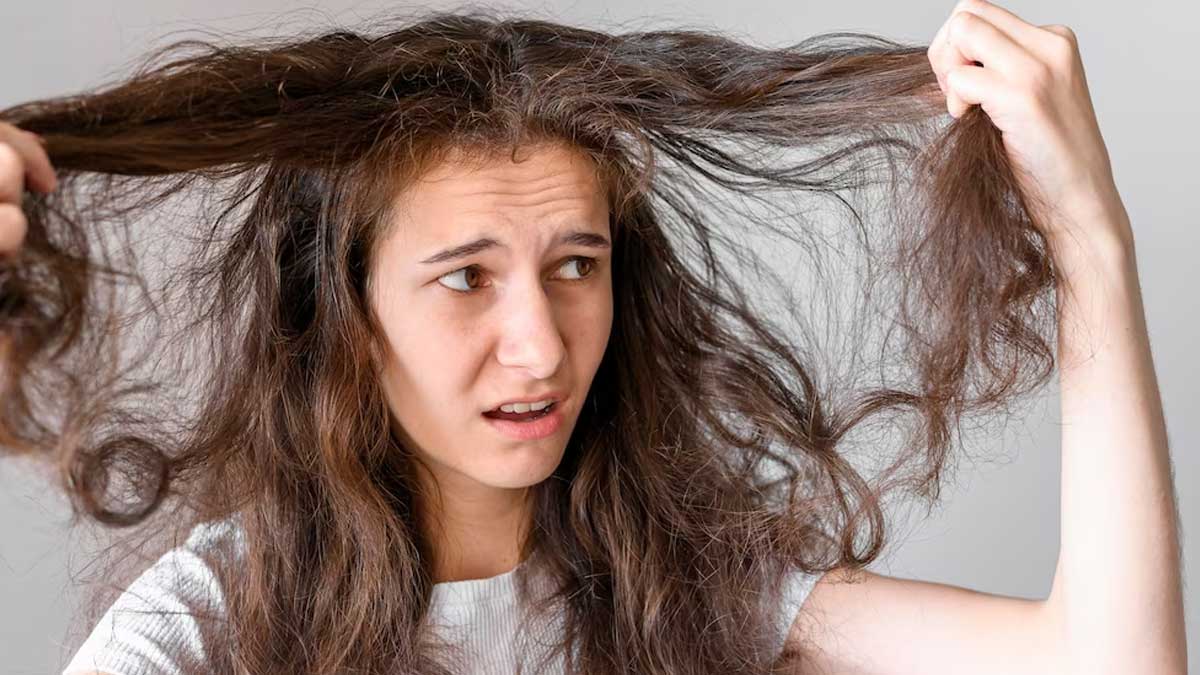 Ayurvedic Remedies For Frizzy Hair, Expert Explains 