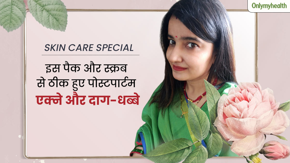 डिलीवरी के बाद मुंहासों, दाग-धब्बों ने खराब कर दिया था चेहरा, साक्षी ने इस तरह दोबारा पाया पहले जैसा ग्लो