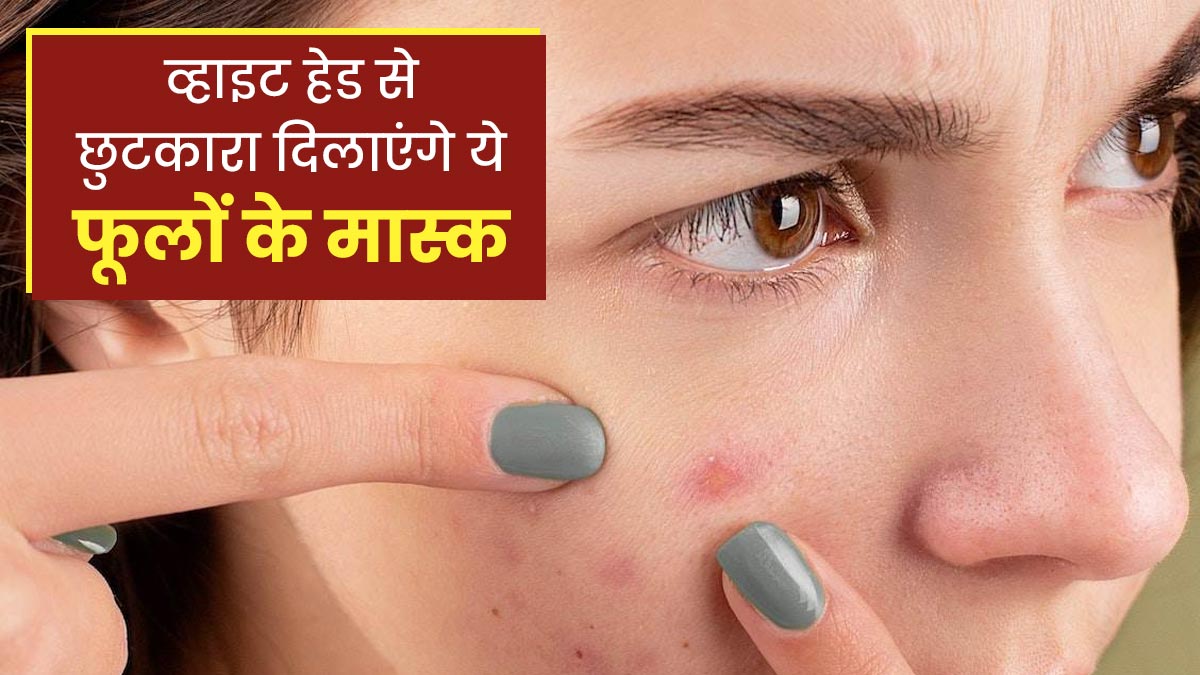 व्हाइट हेड्स से छुटकारा दिलाएगा इन 3 फूलों का फेस मास्क, जानें बनाने का तरीका