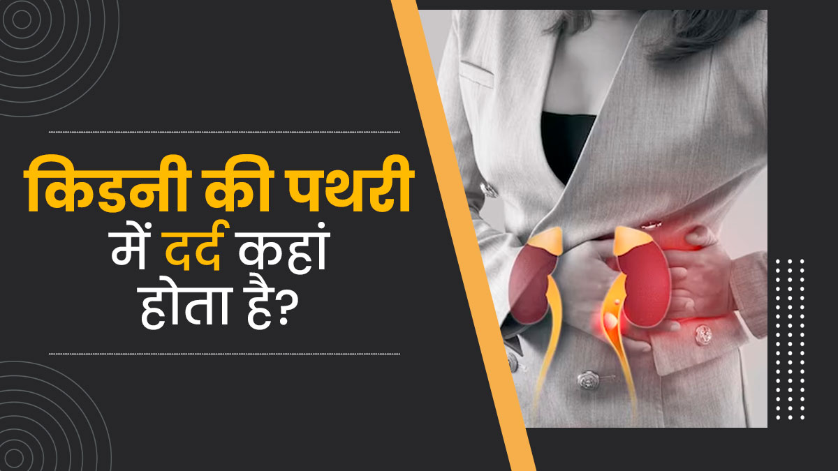 शरीर के इन हिस्सों में हो सकता है किडनी की पथरी का दर्द, बिल्कुल न करें नजरअंदाज