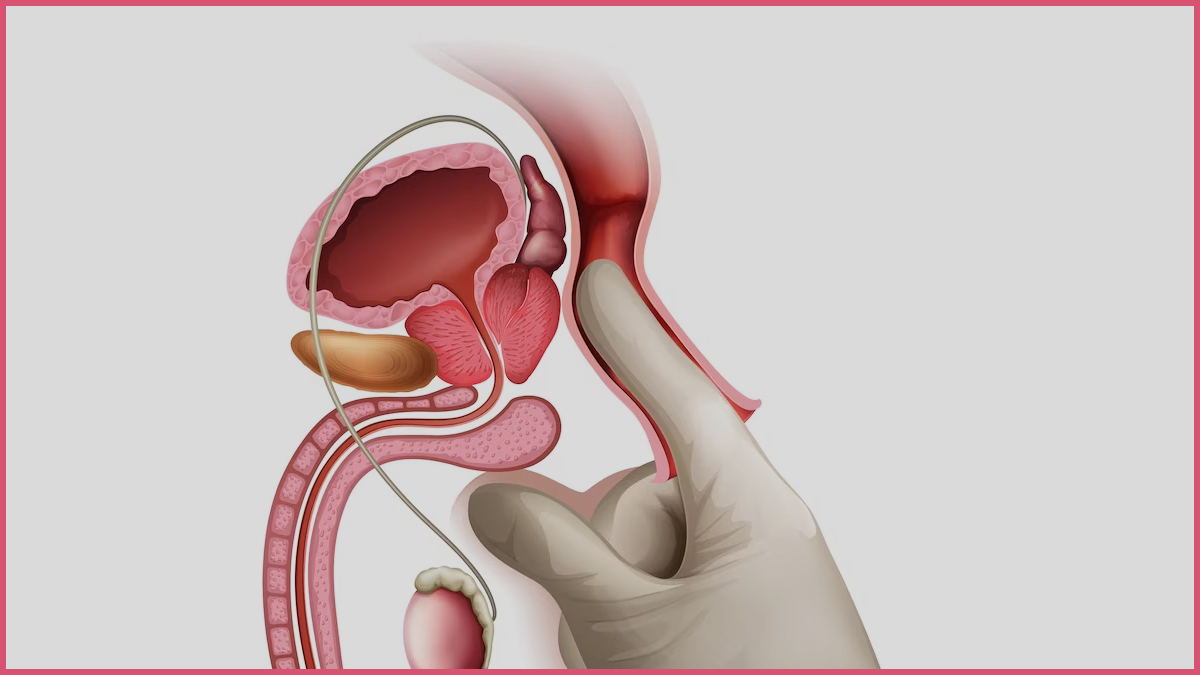 Causes Of Testicular Lumps And Swellings