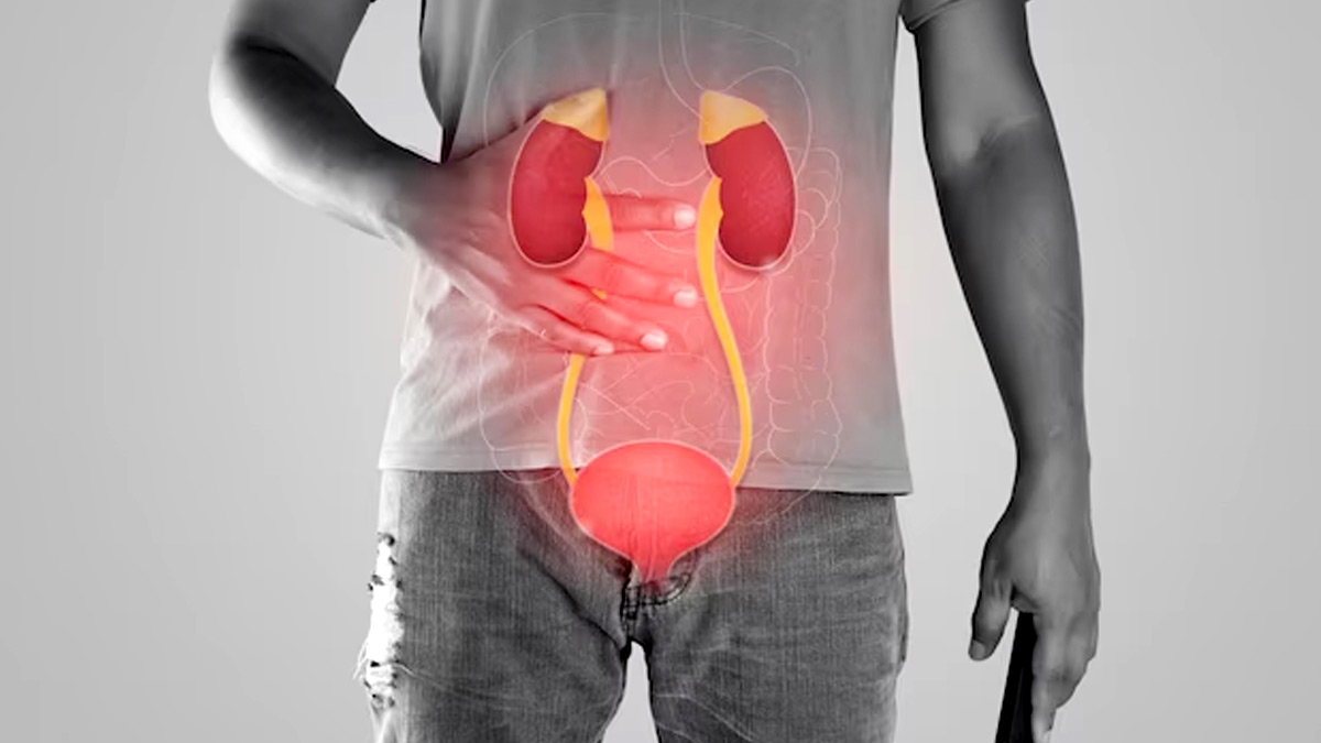 surgery in kidney stone