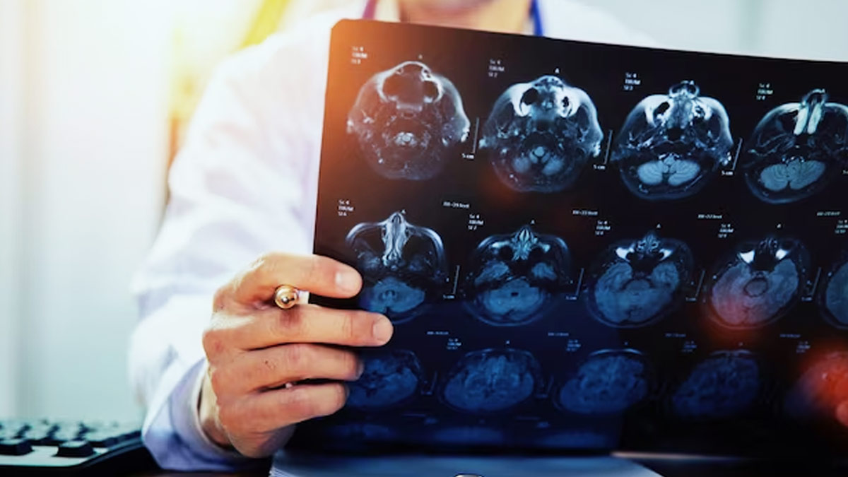 brain disease and tumor sign and symptoms