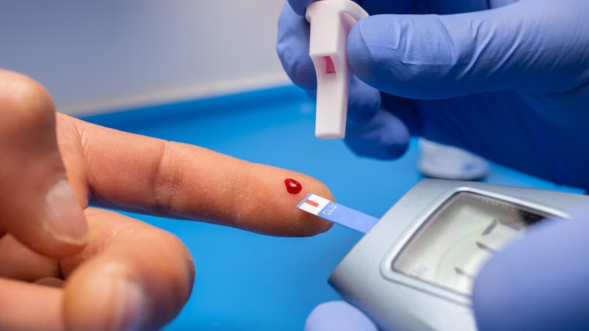 What is Normal Insulin Level in Blood