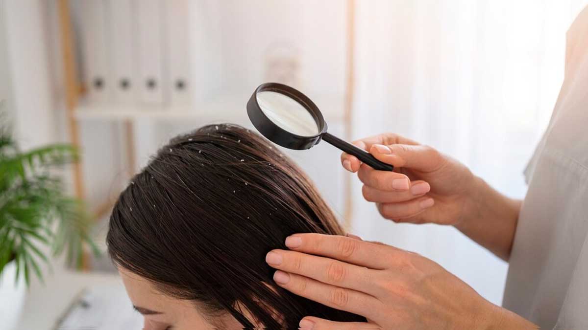 Dry Scalp Vs Dandruff: Experts Explains How To Differentiate Between The Two