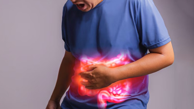 Coping With Crohn's Flares: Expert Guidance And Treatment Strategies