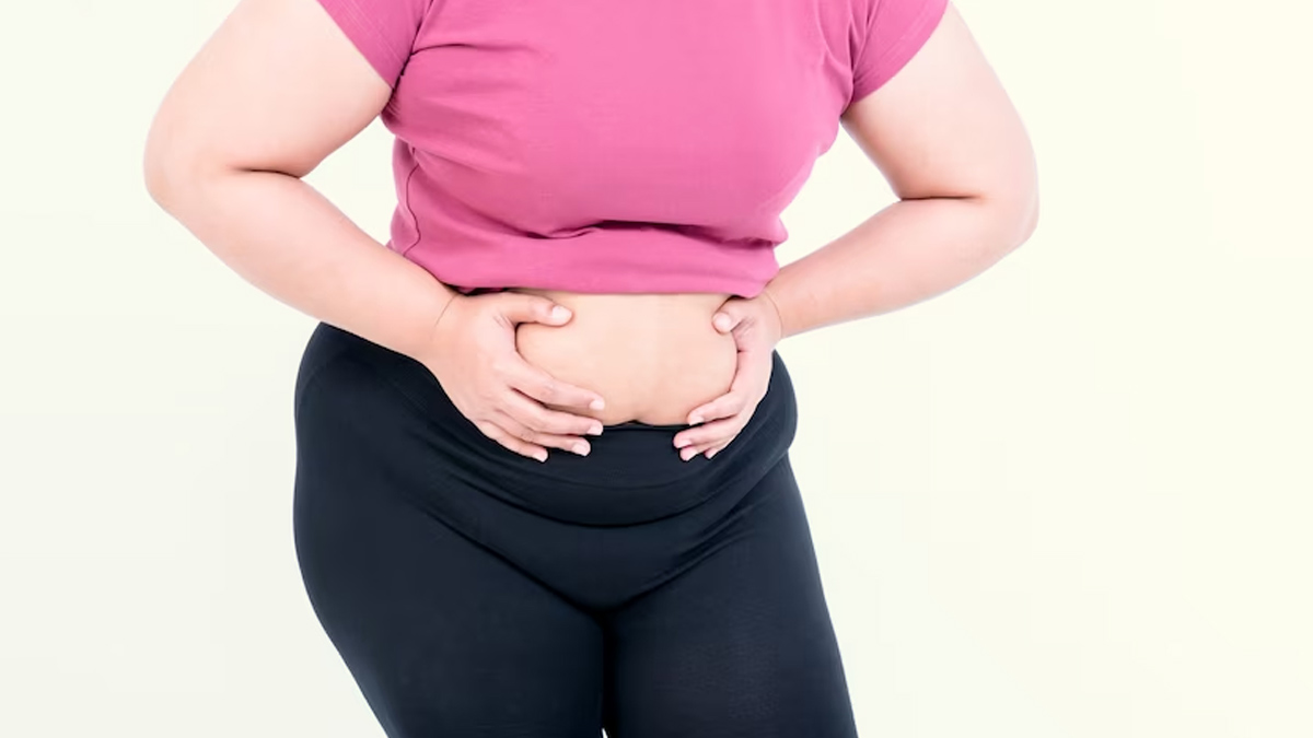 High Sugar Diets and Obesity Linked to Neurodegenerative Disorders