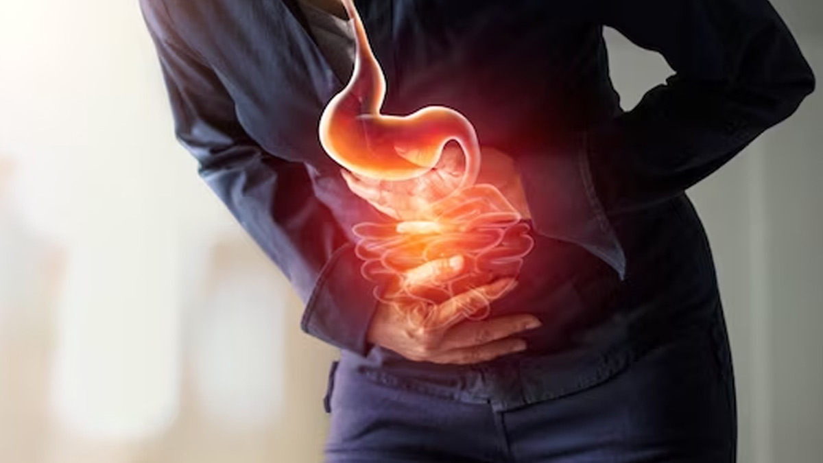 How Does Stress Cause Acidity? Doctor Answers, Shares Tips To Manage Acid Reflux