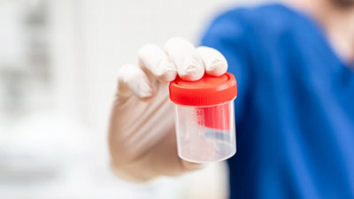 Can Synthetic Pee Be Detected In A Lab? Full Guide: How To Pass A Quest Diagnostics Urine Test