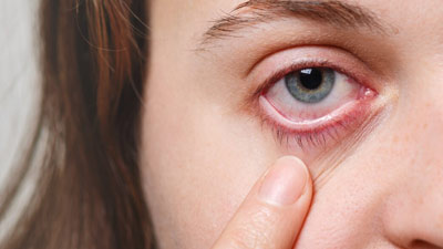 Diabetic Retinopathy: What Are Some Easy Lifestyle Changes To Prevent It