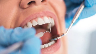 Kalpana Balan, A 26-Year-Old Mother, Sets Guinness World Record For Having 38 Teeth