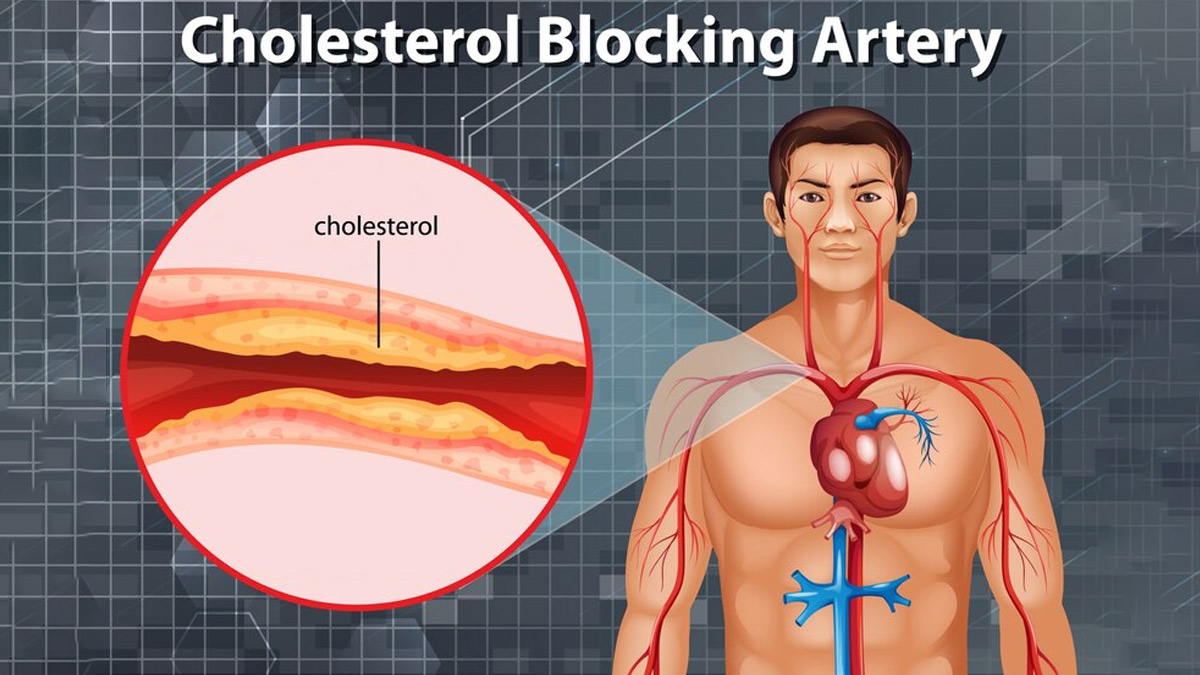 Drinking Tomato Juice On Empty Stomach Helps Lower Cholesterol Levels