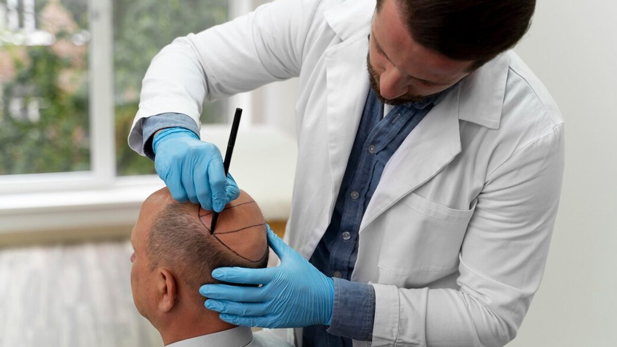 Hair Restoration Options