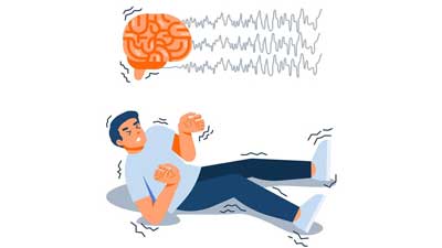 Epilepsy: Expert Explains Treatment Options And Lifestyle Changes