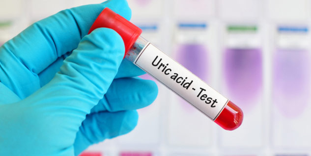 Top Foods to Manage Uric Acid Levels