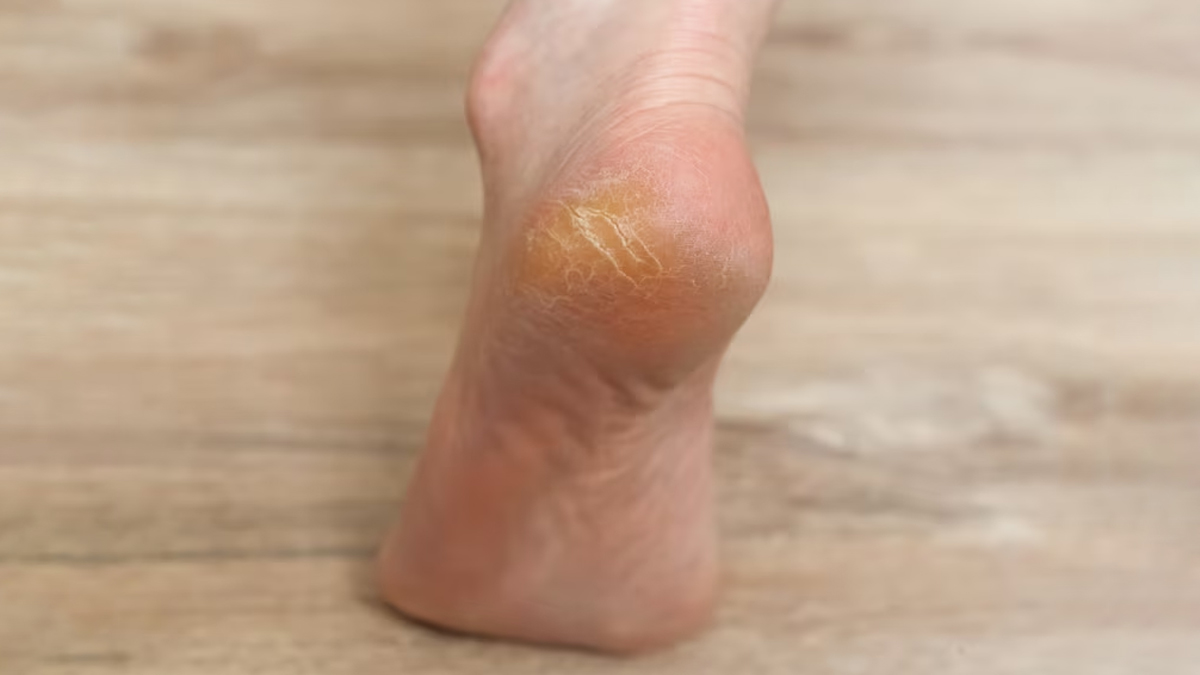 Cream For Heels