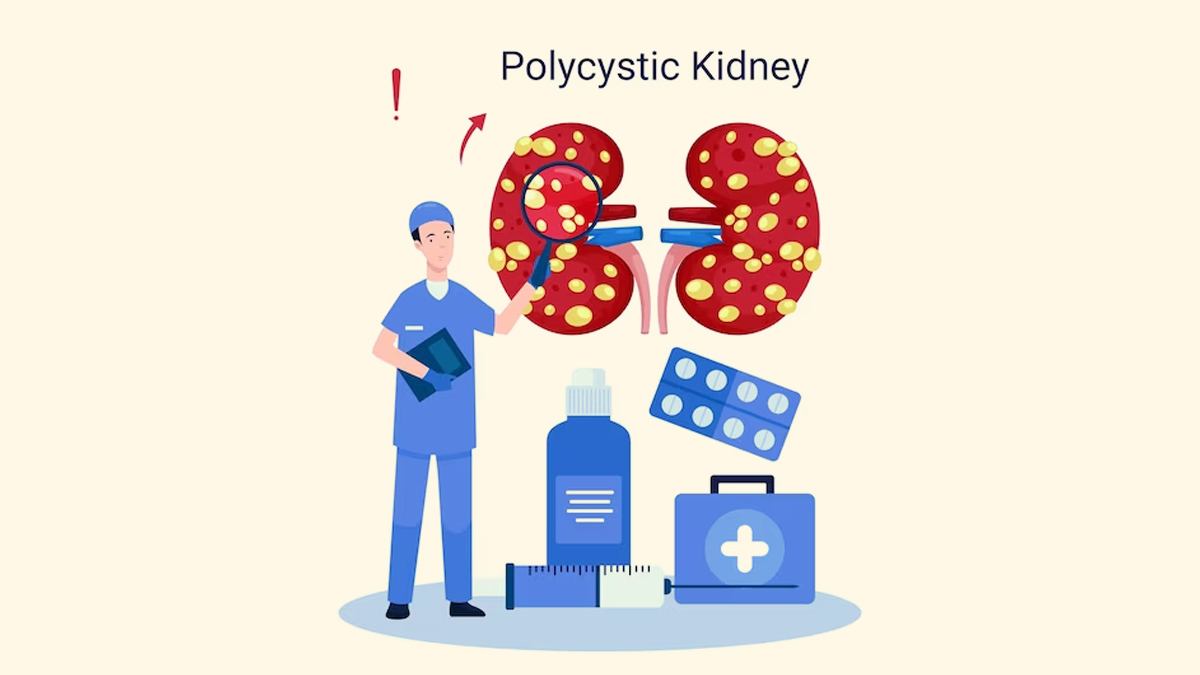 Polycystic-Kidney-Disease