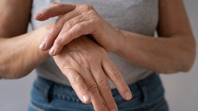 Rheumatoid Arthritis Affects More Than Just Your Joints: Note The Unusual Symptoms Of The Condition