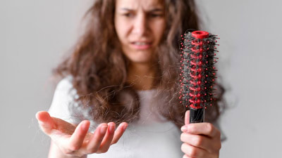 Signs Your Hair Loss Is Alopecia Areata: What Treatments Should You Seek