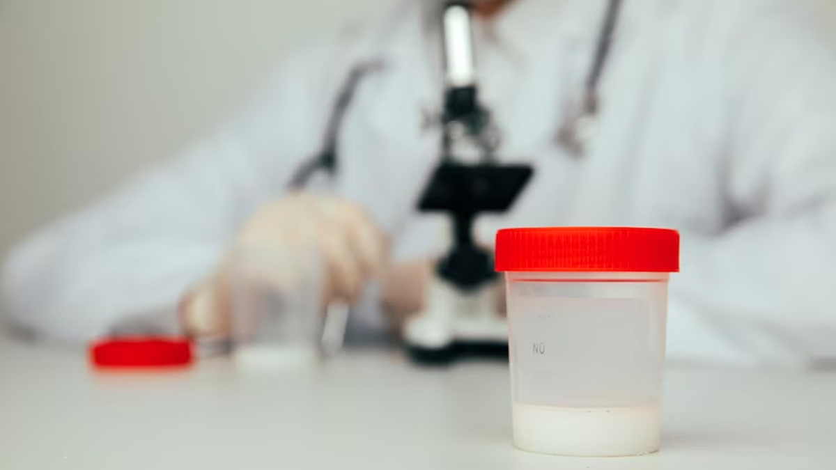 Yellow Semen in Hindi 