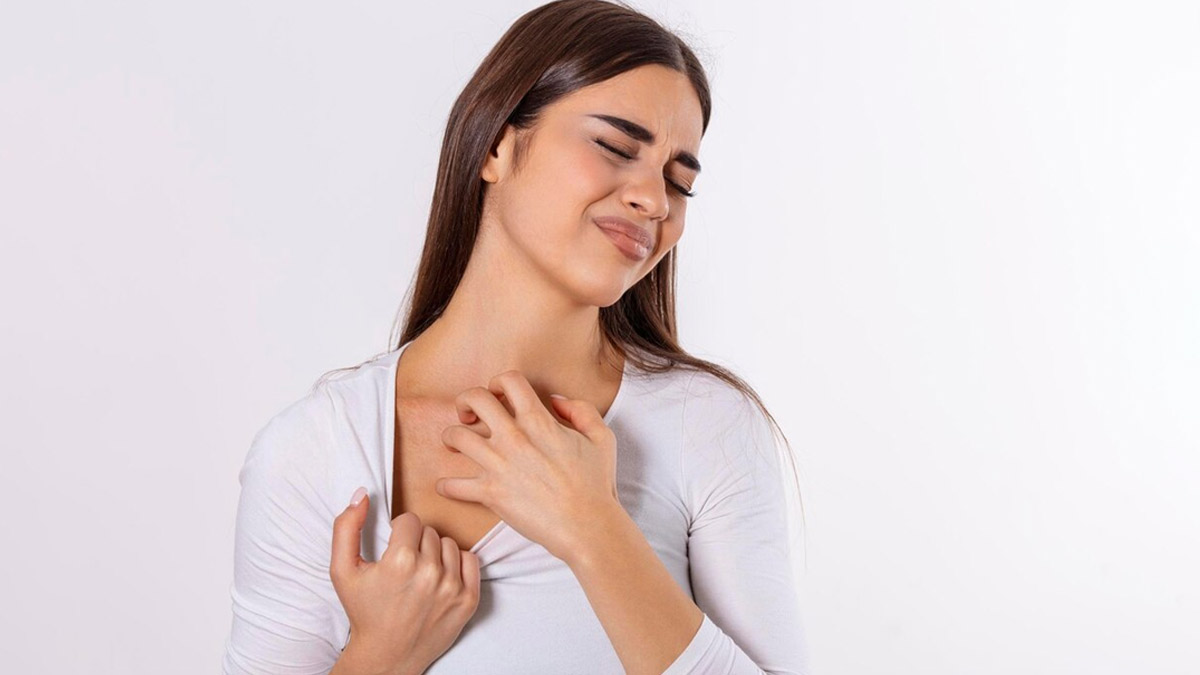 Common Triggers of Psoriasis
