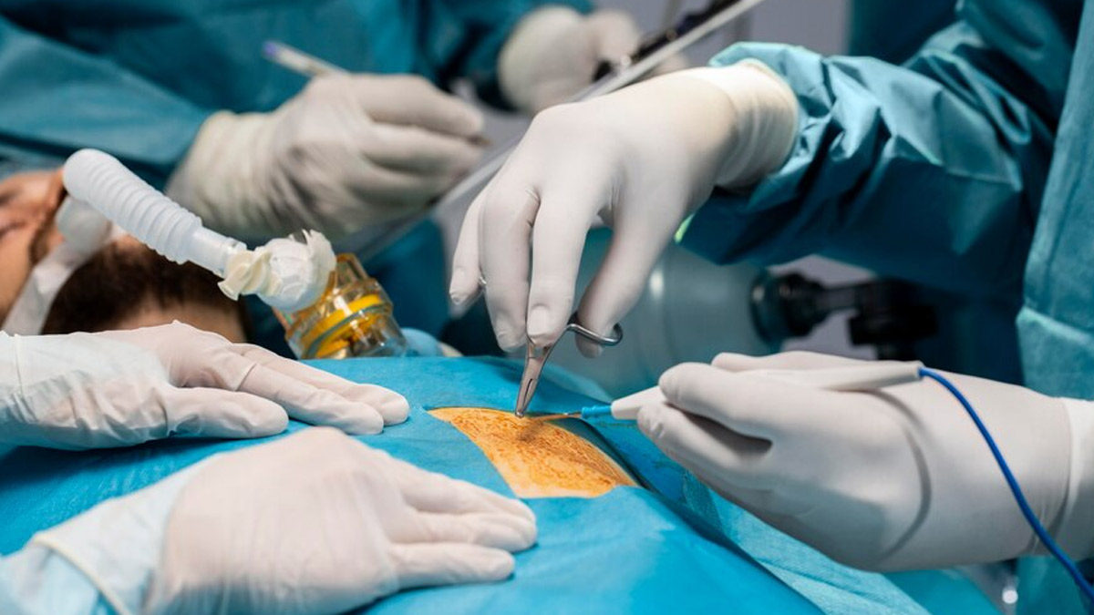 What Not To Do After Kidney Stone Surgery