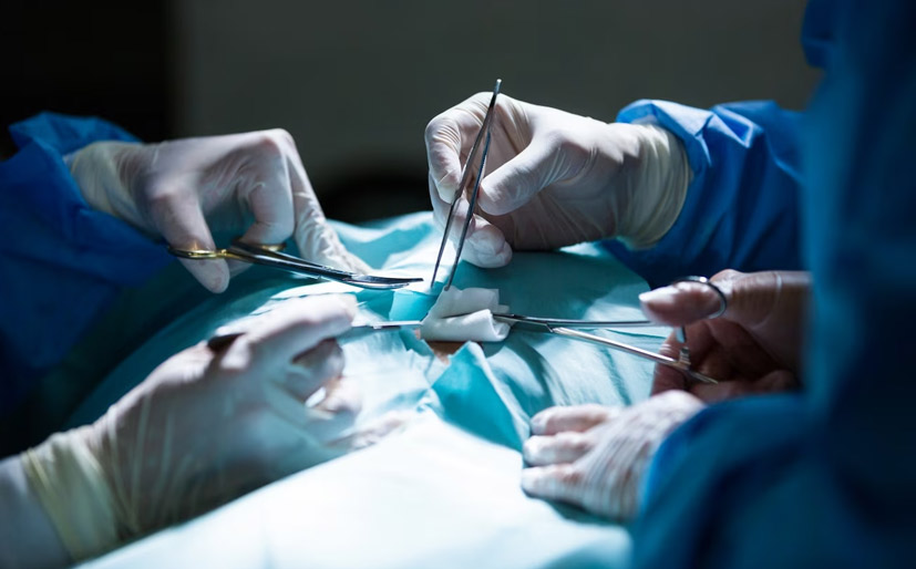 Tips For Fast Recovery After Piles Surgery