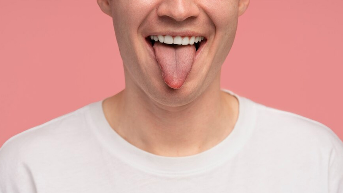 white tongue