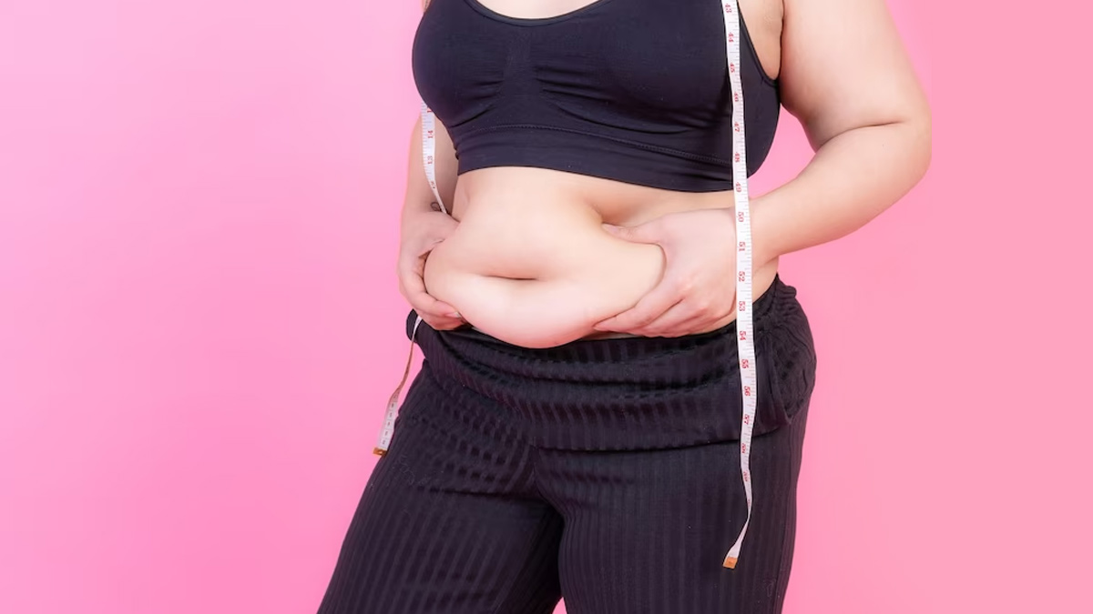 Can Weight Gain Cause Hair Loss