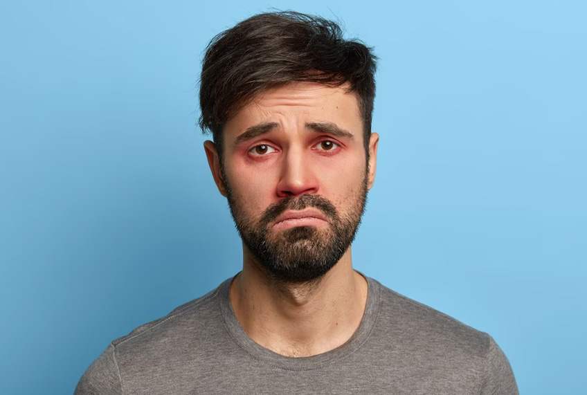 Chronic Watering In Eyes