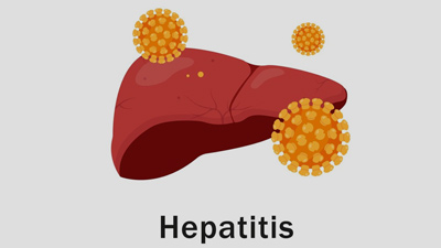 Infectious Causes Of Jaundice: Expert Explains How To Prevent It&nbsp;