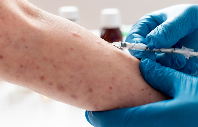 New Strain Of Chickenpox Causing Virus