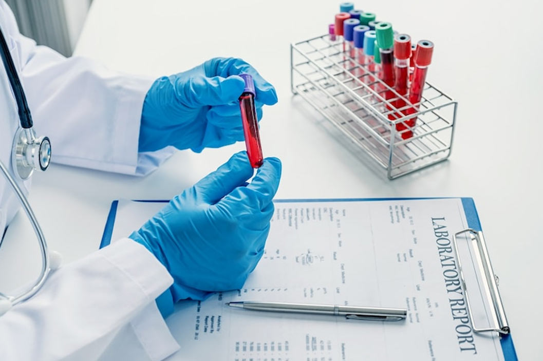 sickle cell disease diagnosis