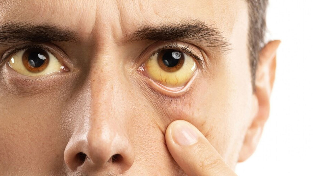 Rare Symptoms of Lymphoma