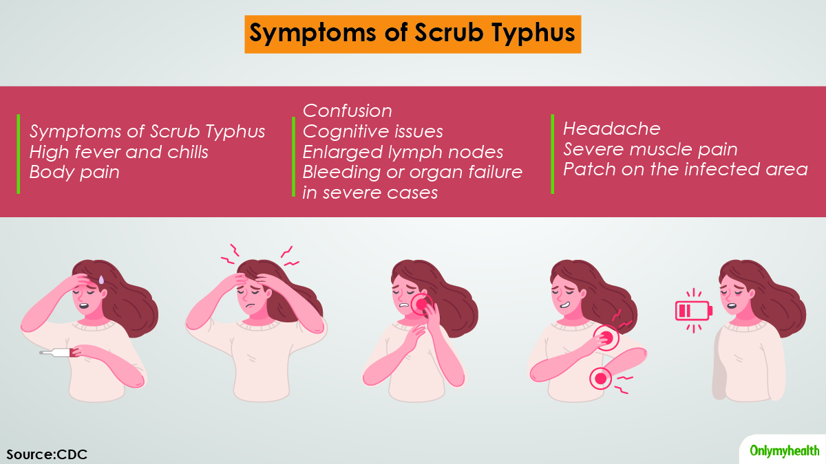 Symptoms of Scrub Typhus