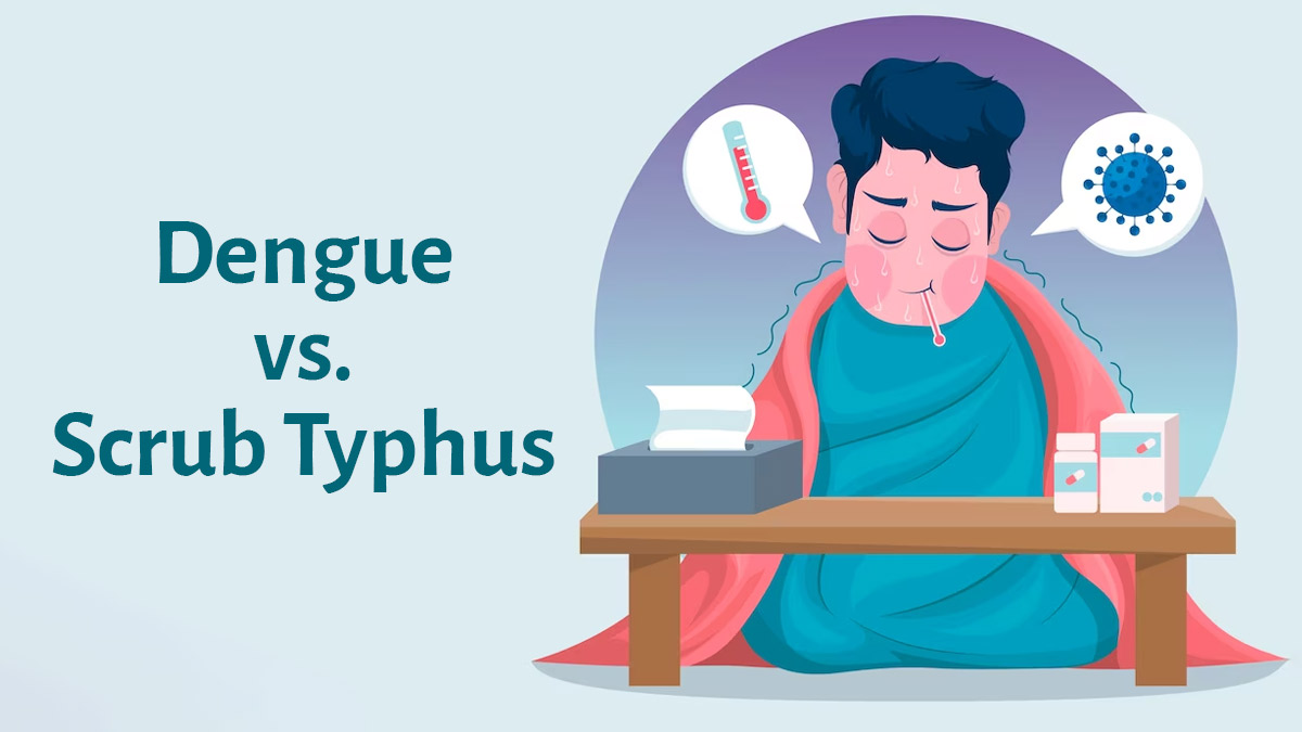 Scrub Typhus Versus Dengue: Warning Signs And Differences Between The Two