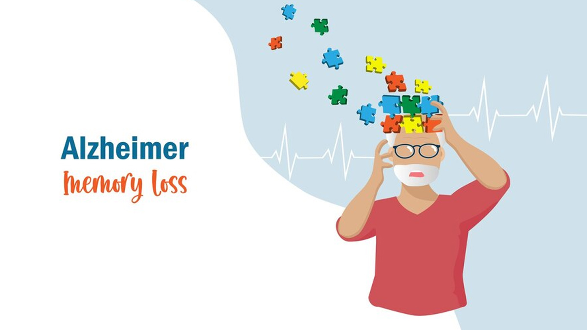 When does Alzheimer's start