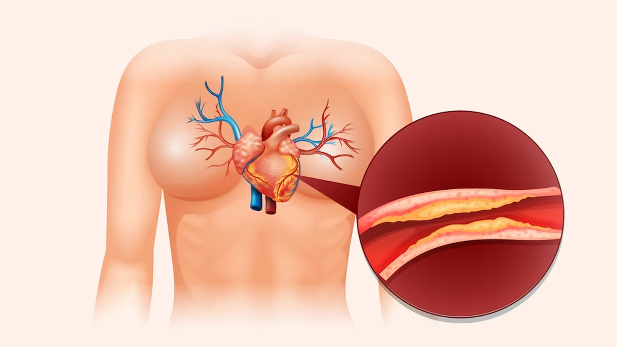 How To Increase Hdl Cholesterol