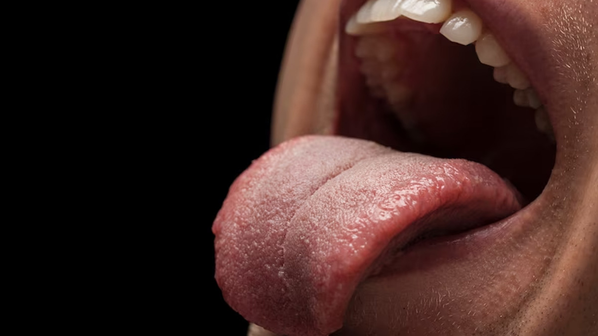 What Your Tongue Tells You About Your Health