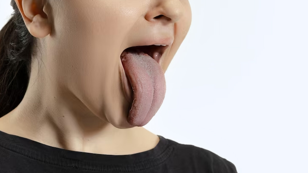 What Your Tongue Tells You About Your Health