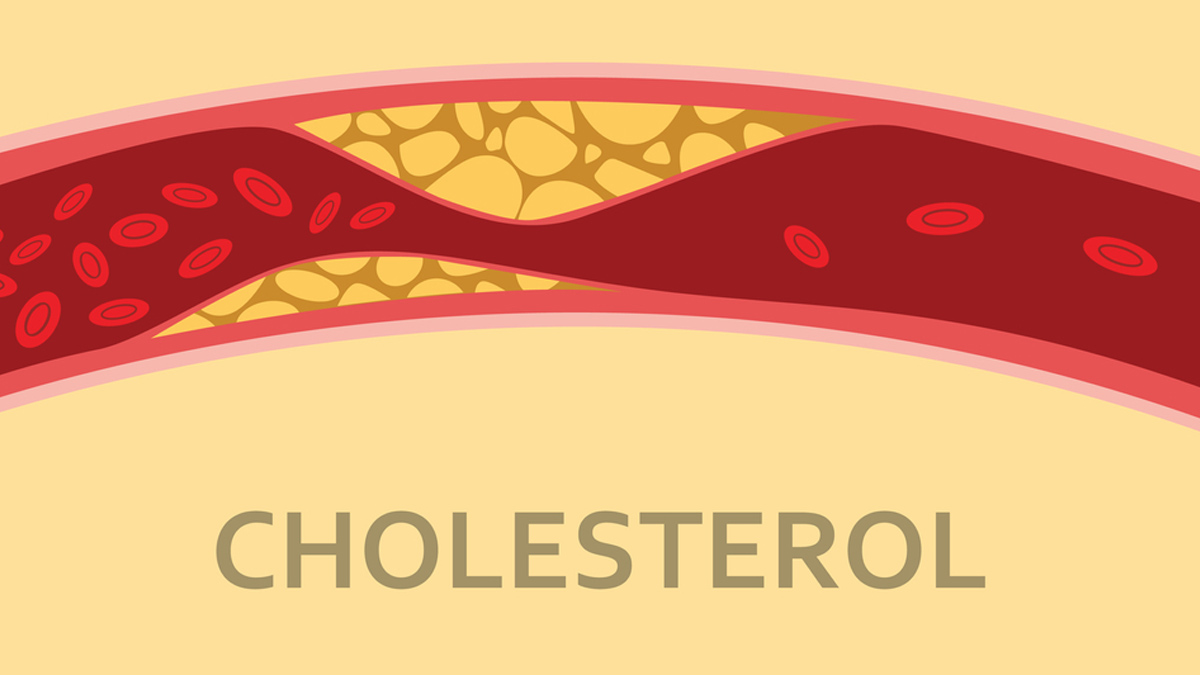 problems caused by low hdl cholesterol normal range